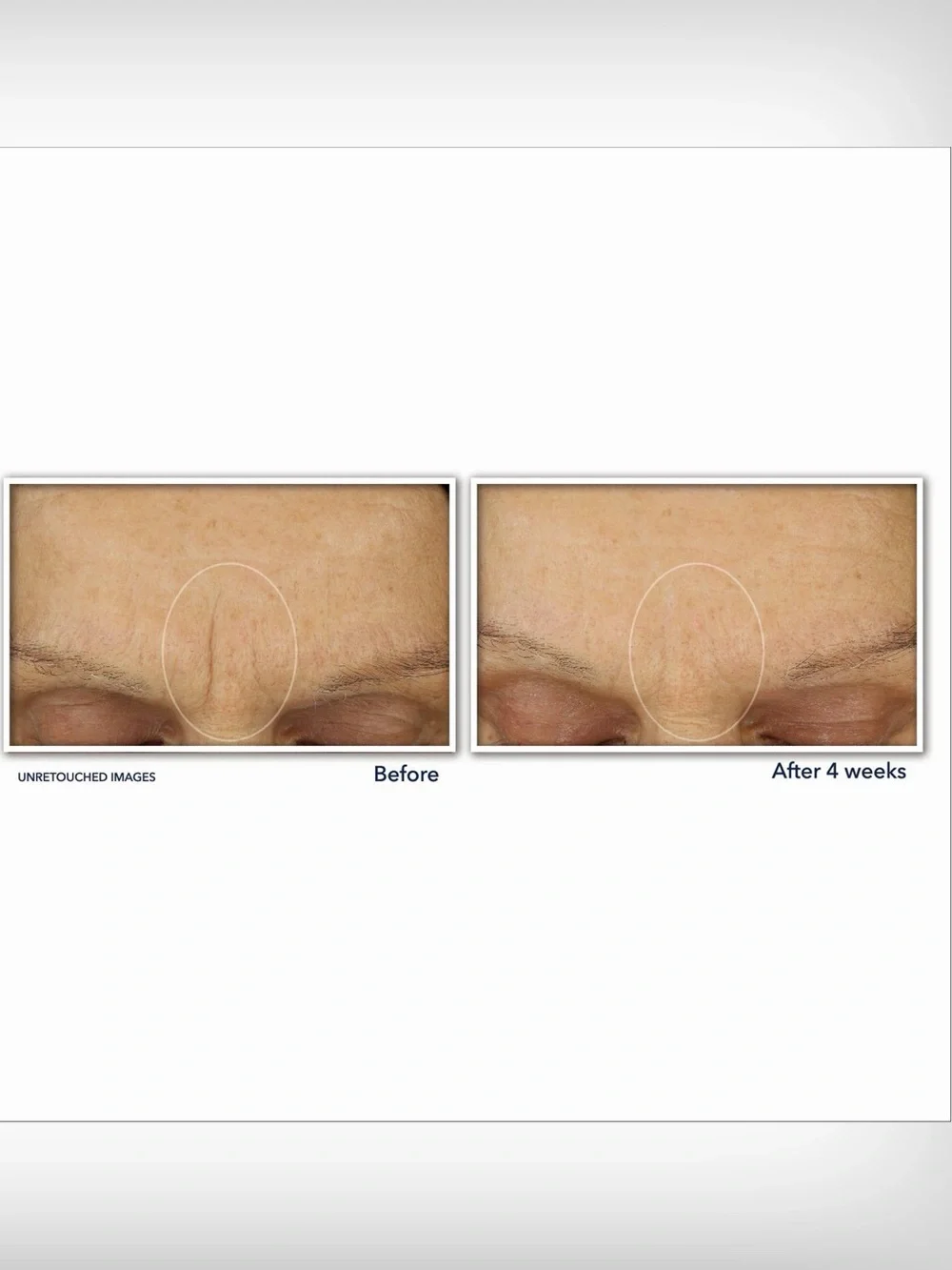 RoC Retinol Correxion Line Smoothing Max Hydration Cream